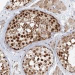 R3HCC1L Antibody in Immunohistochemistry (Paraffin) (IHC (P))