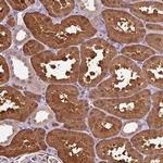Arfaptin 1 Antibody in Immunohistochemistry (Paraffin) (IHC (P))