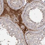 ARL13A Antibody in Immunohistochemistry (Paraffin) (IHC (P))