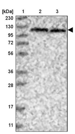 SKIV2L2 Antibody in Western Blot (WB)