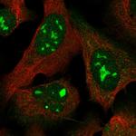 MYL5 Polyclonal Antibody