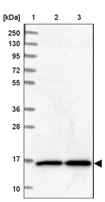 NUDCD2 Antibody in Western Blot (WB)