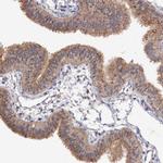 NUDCD2 Antibody in Immunohistochemistry (IHC)