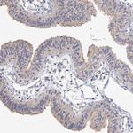 NUDCD2 Polyclonal Antibody