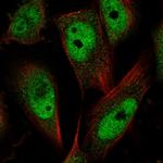 MCC Antibody in Immunocytochemistry (ICC/IF)