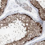 MCC Antibody in Immunohistochemistry (Paraffin) (IHC (P))