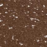 Gemin 5 Antibody in Immunohistochemistry (Paraffin) (IHC (P))