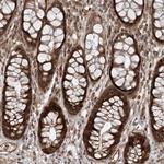 Gemin 5 Antibody in Immunohistochemistry (Paraffin) (IHC (P))