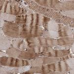 Gemin 5 Antibody in Immunohistochemistry (Paraffin) (IHC (P))