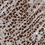 GIN1 Polyclonal Antibody