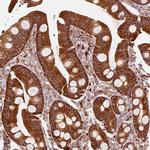 IQGAP2 Antibody in Immunohistochemistry (Paraffin) (IHC (P))