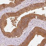 IQGAP2 Antibody in Immunohistochemistry (IHC)