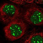 C1D Polyclonal Antibody