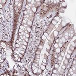 C1D Antibody in Immunohistochemistry (Paraffin) (IHC (P))