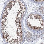 SHE Polyclonal Antibody