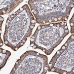 SNX7 Antibody in Immunohistochemistry (IHC)