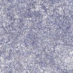 SNX7 Antibody in Immunohistochemistry (IHC)