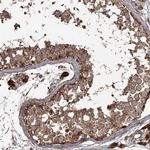 THAP9 Polyclonal Antibody