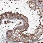 THAP9 Antibody in Immunohistochemistry (IHC)