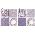 MENT Polyclonal Antibody