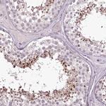 MENT Antibody in Immunohistochemistry (IHC)