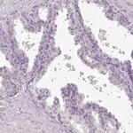 MENT Antibody in Immunohistochemistry (IHC)
