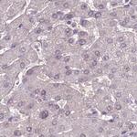 MENT Antibody in Immunohistochemistry (IHC)