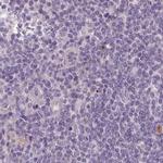 MENT Antibody in Immunohistochemistry (IHC)