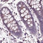 MENT Antibody in Immunohistochemistry (IHC)