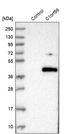 MENT Antibody in Western Blot (WB)