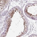 MENT Antibody in Immunohistochemistry (Paraffin) (IHC (P))