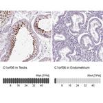 MENT Antibody in Immunohistochemistry (IHC)