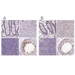MENT Antibody in Immunohistochemistry (IHC)