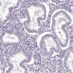 MENT Antibody in Immunohistochemistry (IHC)