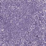 MENT Antibody in Immunohistochemistry (IHC)