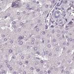 MENT Antibody in Immunohistochemistry (IHC)