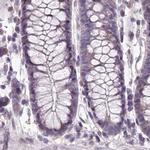 MENT Antibody in Immunohistochemistry (IHC)