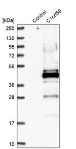 MENT Antibody in Western Blot (WB)