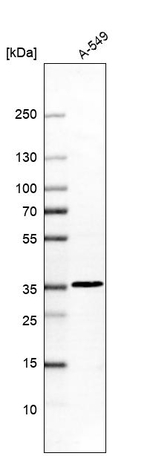 DULLARD Antibody in Western Blot (WB)