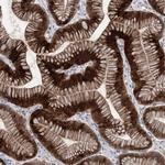 METTL24 Polyclonal Antibody