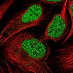 NSMCE4A Polyclonal Antibody