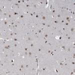 NSMCE4A Antibody in Immunohistochemistry (Paraffin) (IHC (P))