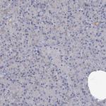 NSMCE4A Antibody in Immunohistochemistry (Paraffin) (IHC (P))