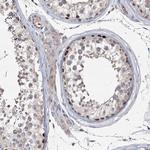 NSMCE4A Antibody in Immunohistochemistry (Paraffin) (IHC (P))