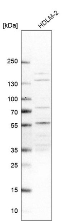 NSMCE4A Antibody in Western Blot (WB)