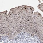 NSMCE4A Antibody in Immunohistochemistry (IHC)