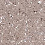 RANBP3L Antibody in Immunohistochemistry (Paraffin) (IHC (P))
