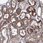 RANBP3L Antibody in Immunohistochemistry (Paraffin) (IHC (P))