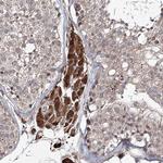 RANBP3L Antibody in Immunohistochemistry (Paraffin) (IHC (P))