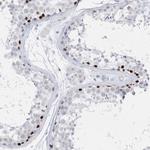 TMCO6 Polyclonal Antibody